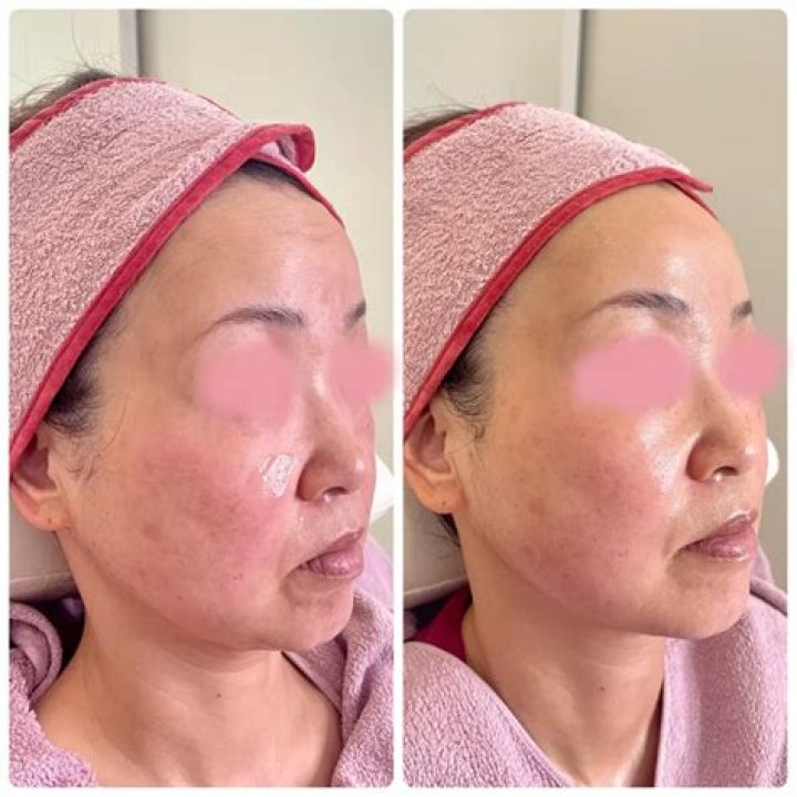 beforeafter beforeafter