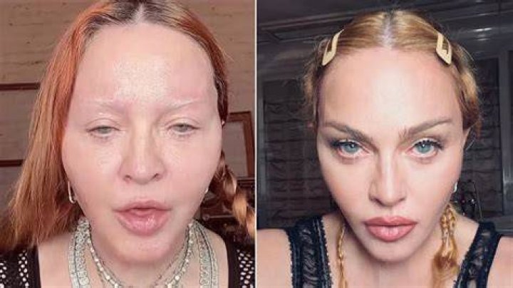 bitchy | madonna puffy face