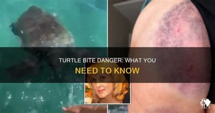 Can turtles bite people?