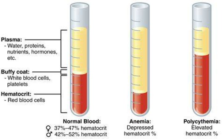 How much does phlebotomy lower hematocrit?