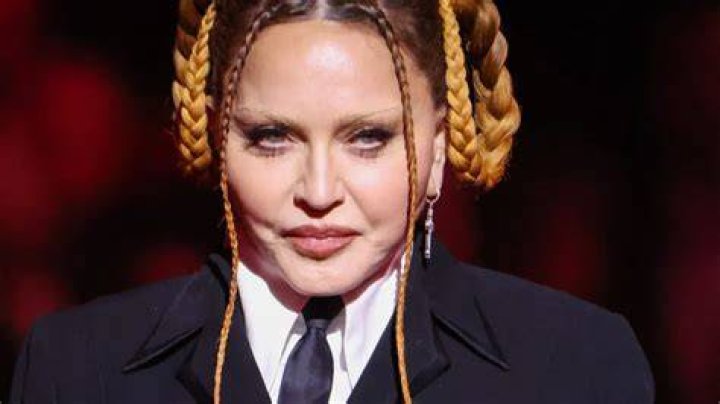 Madonna: ‘Look how cute i am now that swelling from surgery has gone down. Lol’