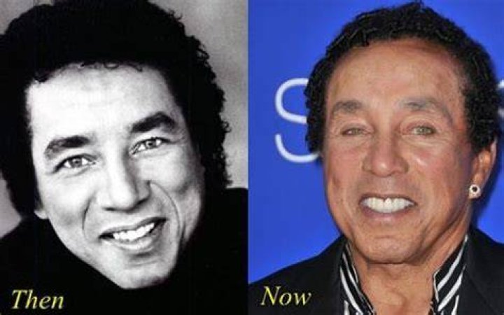 Smokey Robinson Facelift
