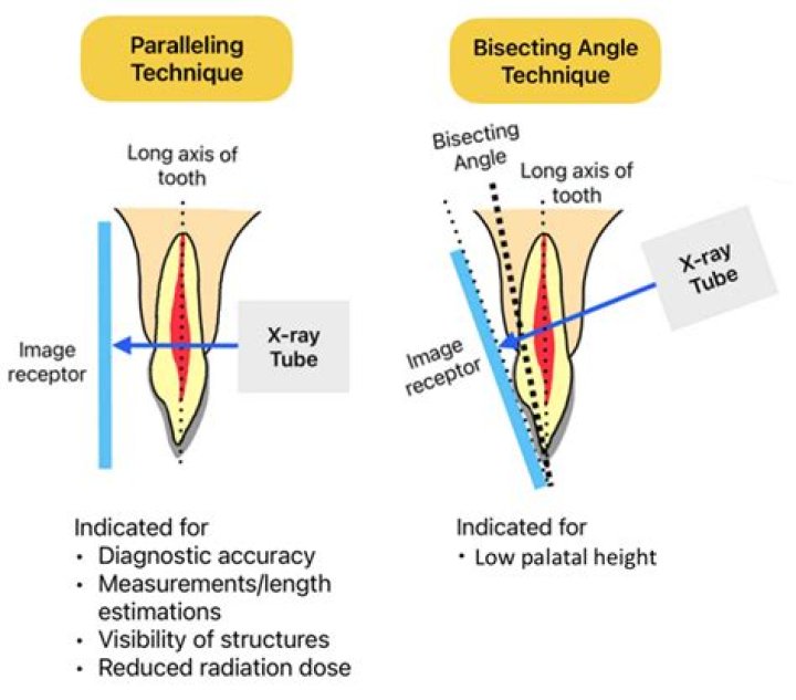 What is the bisecting angle technique?