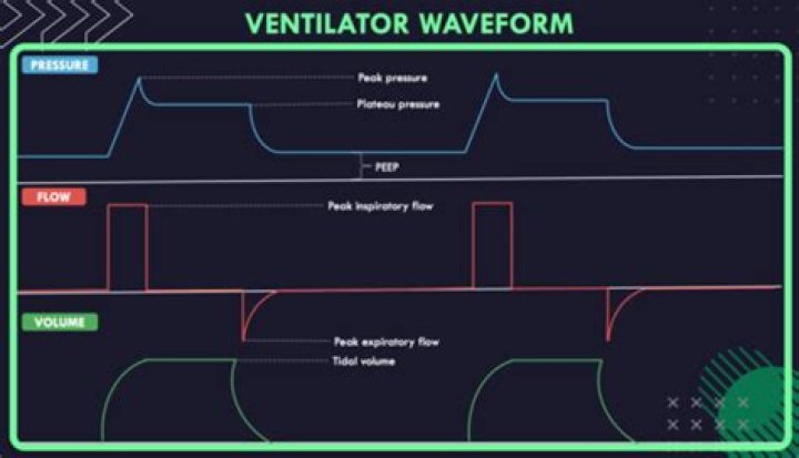 What is ventilation quizlet?