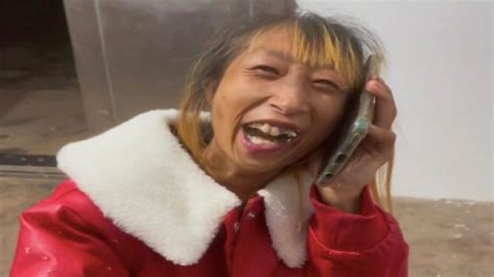 Xiao Xiao disability